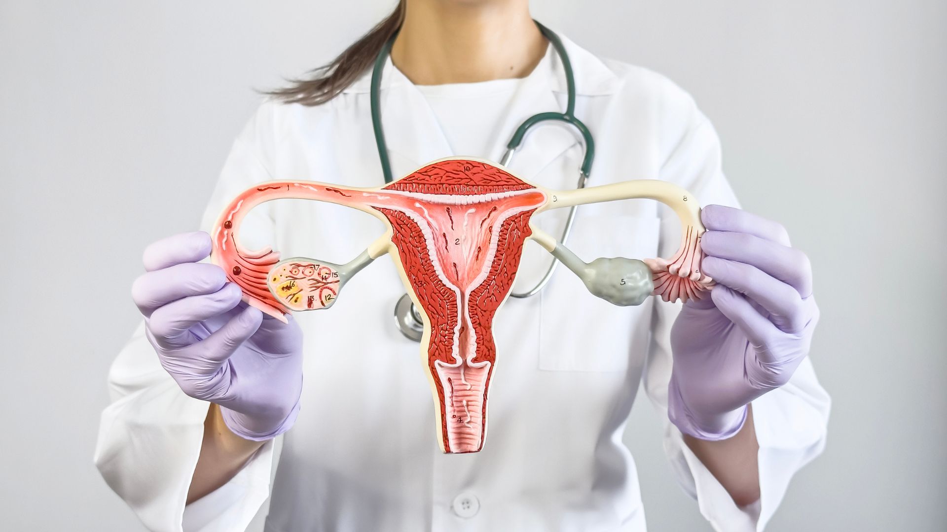 Tipos de Tratamiento para los Ovarios Poliquísticos